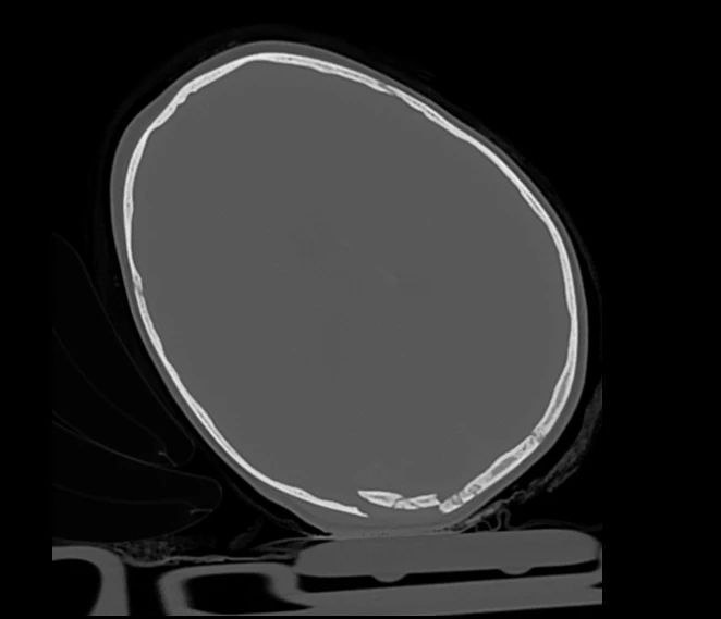 Ребенок, выпавший из окна в Улан-Удэ, находится в крайне тяжелом состоянии