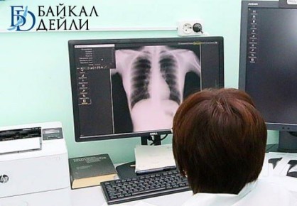 В Бурятии активный туберкулёз за год нашли почти у 300 человек